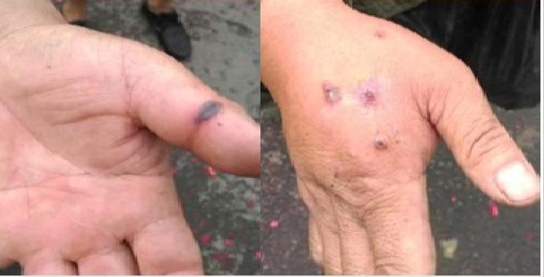 北京疫情现状，是否越来越严重了？